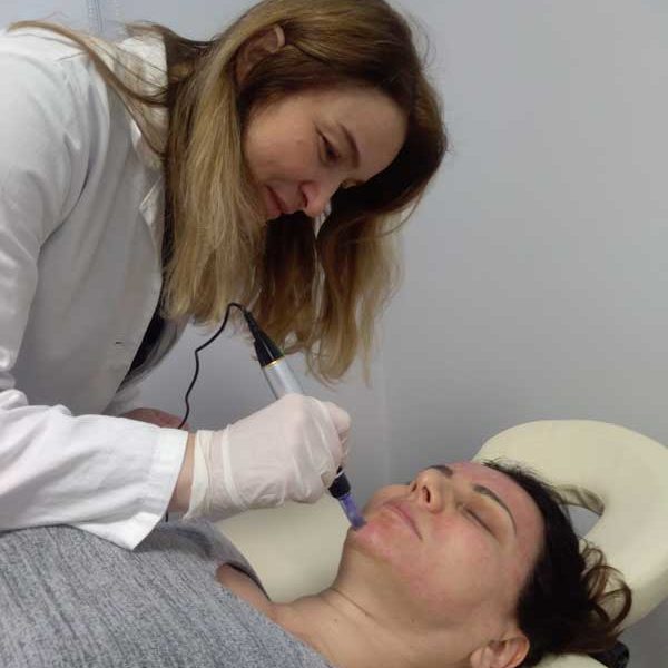 dr Olgica Mrđa - Mezoterapija